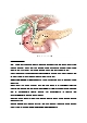 신규간호사도 이해할 수 있게 만든 담관염 자료(시술 및 이미지)